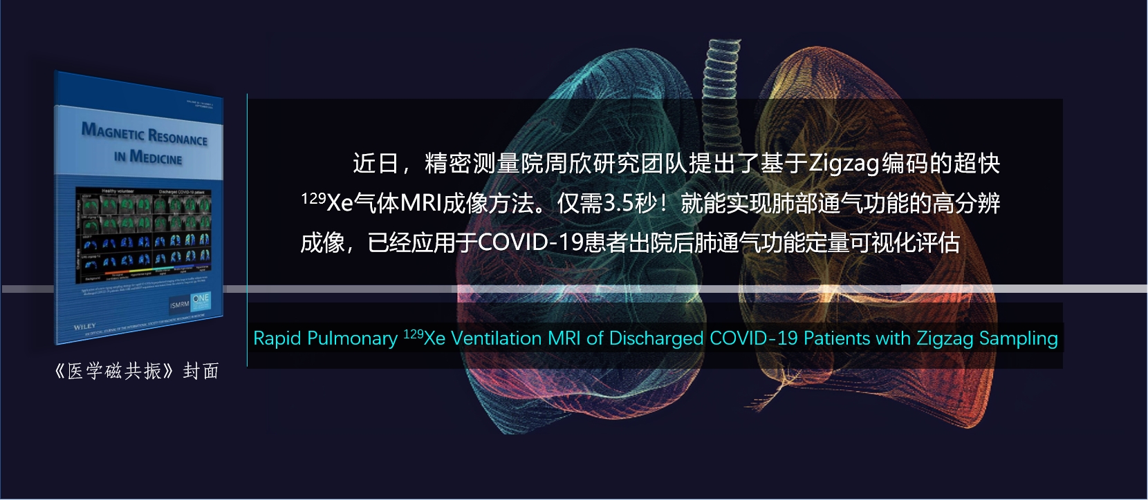 3.5秒成像！精密测量院实现超快、高分辨3D多核<sup>129</sup>Xe MRI肺部通气功能定量可视化评估